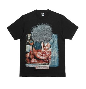 T-SHIRT - MEDICAL TERATOCARCINOMA ANUS – CADAVER ORGAN SURGERY